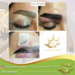 کاشت ابرو در مشهد