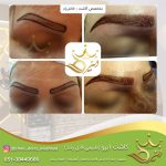 کاشت ابروی طبیعی