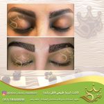 کاشت ابرو در مشهد